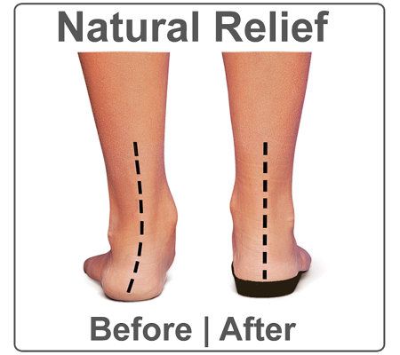 Orthaheel Tide Orthotic Ladies Thong Sandals