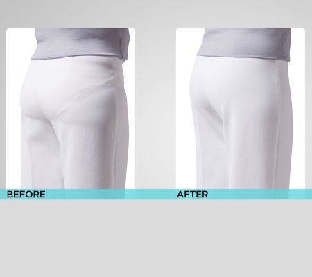 Spanx Hide and Sleek Hi-Rise Capri Smoother