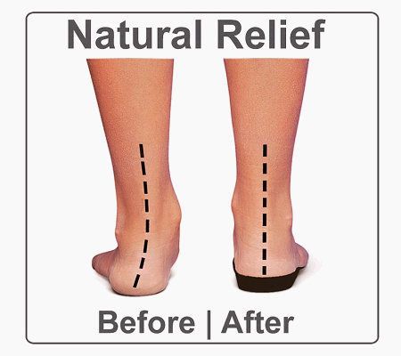 Orthaheel Yolanda Orthotic Metal Ring Adj. Thong Sandals