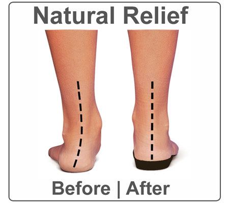 Orthaheel Porto Orthotic Sandals with Ornament Detail