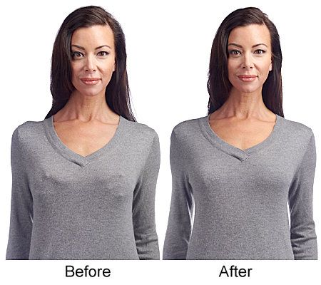 Breezies Set of 2 Lace Eclipse Underwire Bras with UltimAir